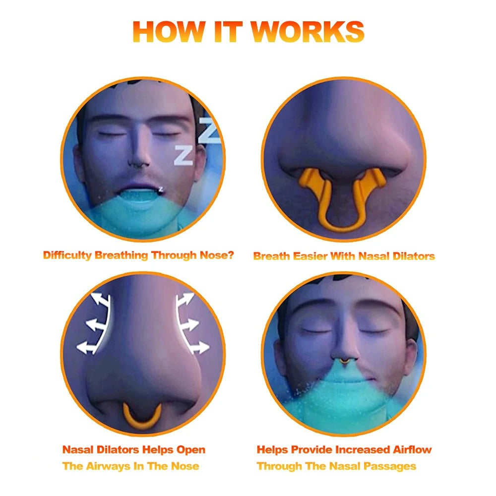 Sleepease Nasal Dilator