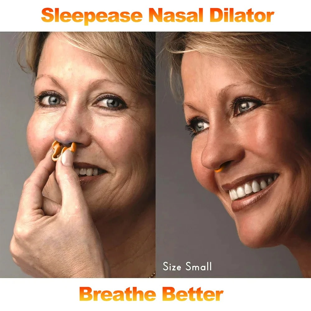 Sleepease Nasal Dilator