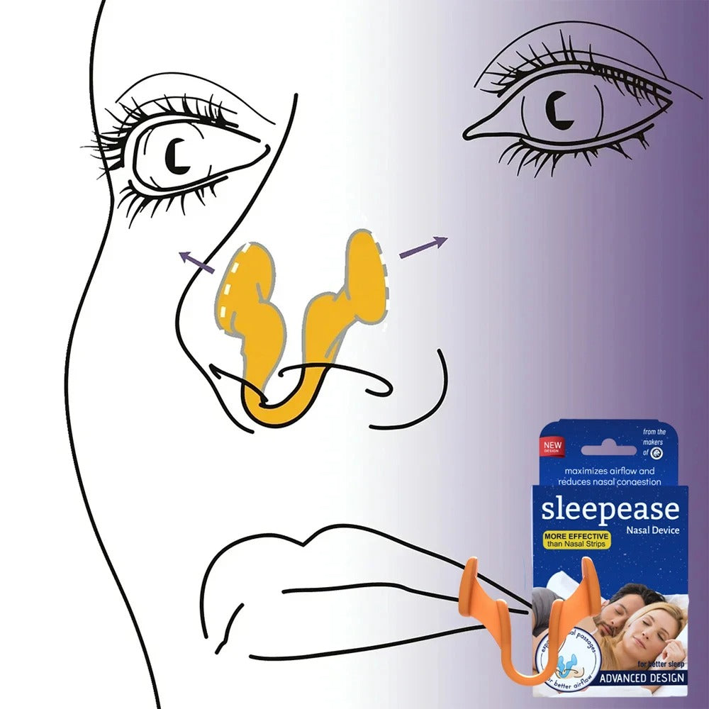Sleepease Nasal Dilator