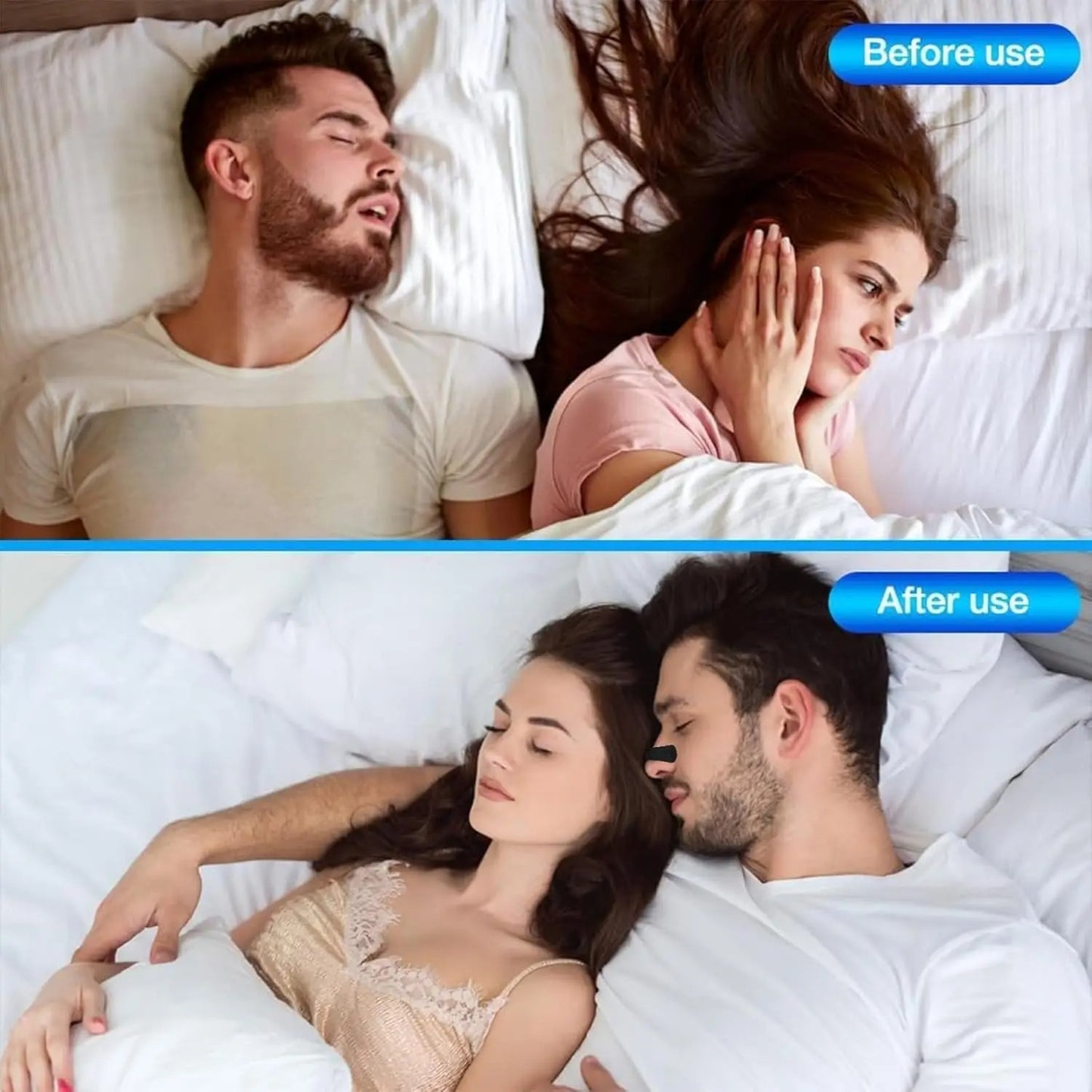 BreatheEase Nasal Strips
