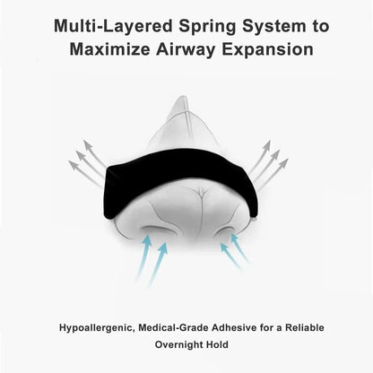 BreatheEase Nasal Strips