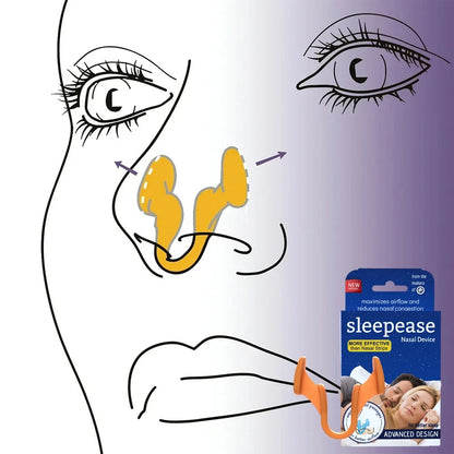 Sleepease Nasal Dilator